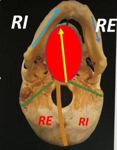 Cranio-Mandibola in Torsione